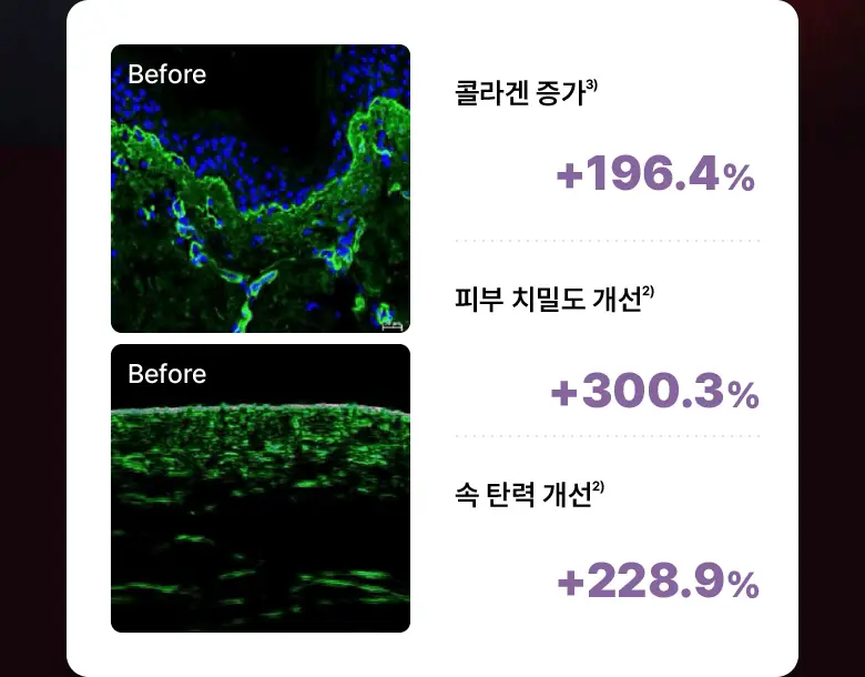 [슈링크연구진공동개발] 바이오힐보 프로바이오덤 콜라겐 세럼+슈링크기기 상세페이지 16